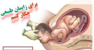 زایمان طبیعی و چند روش آماده سازی بدن