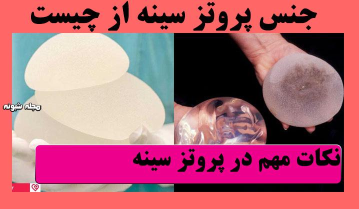 پروتز سینه و معایب و مزایای پروتز سینه + قبل از پروتز سینه بخوانید