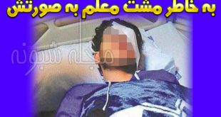 کور شدن آرش دانش آموز 18 ساله توسط مشت معلم
