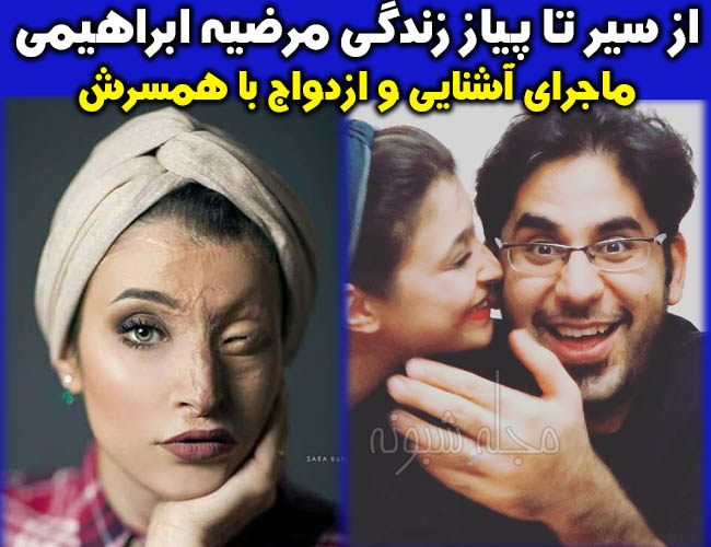 مرضیه ابراهیمی قربانی اسیدپاشی و همسرش | بیوگرافی و عکس مرضیه ابراهیمی