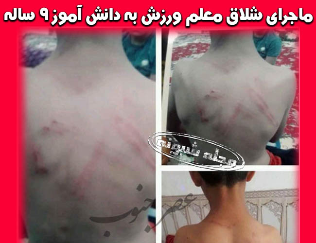 شلاق معلم ورزش بر بدن دانش آموز 9 ساله در کارون خوزستان +تصاویر