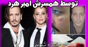 قطع انگشت جانی دپ توسط امبر هرد همسرش +خشونت