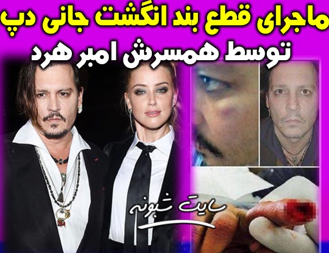 گاز گرفتن انگشت جانی دپ توسط امبر هرد همسرش + قطع بند انگشت جانی دپ