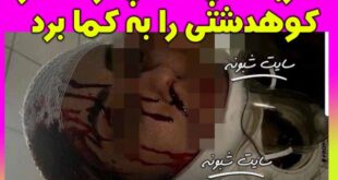 دختر کوهدشتی با ضربات پتک پدرش به کما رفت +عکس