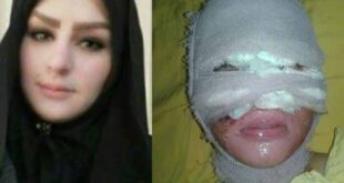 بیوگرافی تهیمنه یوسفی قربانی اسیدپاشی پدر و برادرش + اینستاگرام