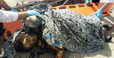 علت مرگ روناک عزیزوند دختر 15 ساله در ارومیه +عکس و جزئیات