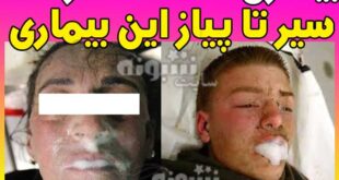 ویروس و بیماری ناشناخته هند و ماجرای شیوع ویروس هندی