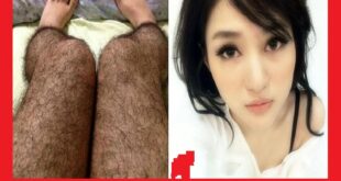 جوراب شلواری پوشیده از مو برای جلوگیری از تجاوز
