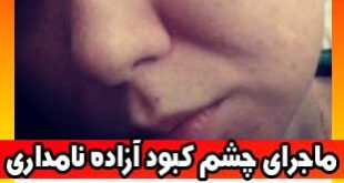 کتک زدن آزاده نامداری توسط فرزاد حسنی و چشم کبود آزاده نامداری