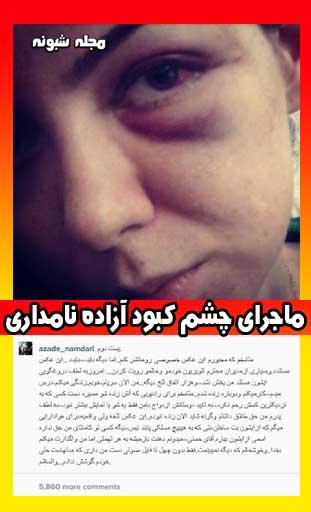 کتک زدن آزاده نامداری توسط فرزاد حسنی و چشم کبود آزاده نامداری 