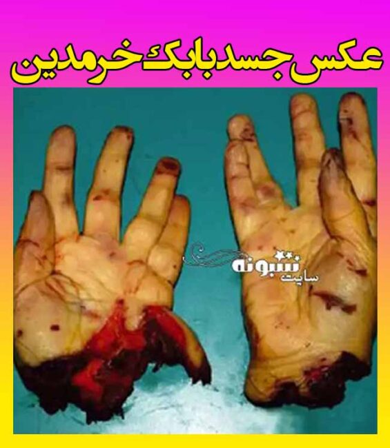عکس جسد بابک خرمدین کارگردان سینما و عکس جسد قطعه قطعه شده بابک خرمدین
