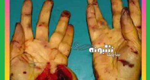 عکس جسد تکه تکه شده بابک خرمدین کارگردان را ببینید (18+) جزئیات و حواشی تصاویر جسد قطعه قطعه شده بابک خرمدین در سطل زباله