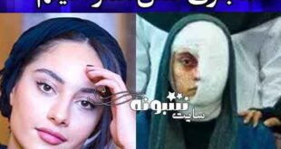 ماجرای اسید پاشی ترلان پراونه چیست؟ +فیلم و عکس