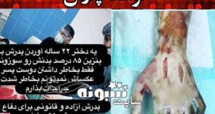 ماجرای آتش زدن دختر سنندجی به دلیل داشتن دوست پسر توسط پدرش