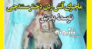عکس سوزاندن دختر 22 سنندجی توسط پدرش به خاطر دوست پسر +جزئیات