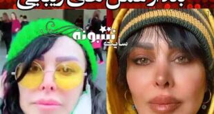 چهره جدید بعد عمل زیبایی فلور نظری +عکس جدید و فیلم