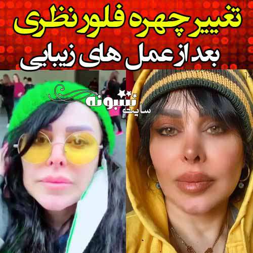 چهره جدید بعد عمل زیبایی فلور نظری +عکس جدید و فیلم