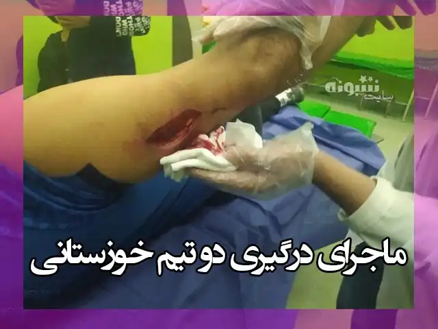 فیلم کامل چاقو کشی در بازی استقلال شوش و شهدای دوکوهه اندیمشک
