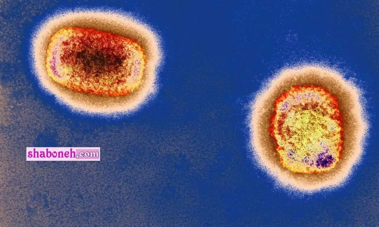 آبله میمون چیست نحوه ابتلا و علائم و نشانه های ویروس بیماری آبله میمون