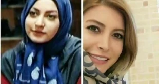 عکس جدید فریبا نادری همه را شوکه کرد + عکس قبل عمل زیبایی