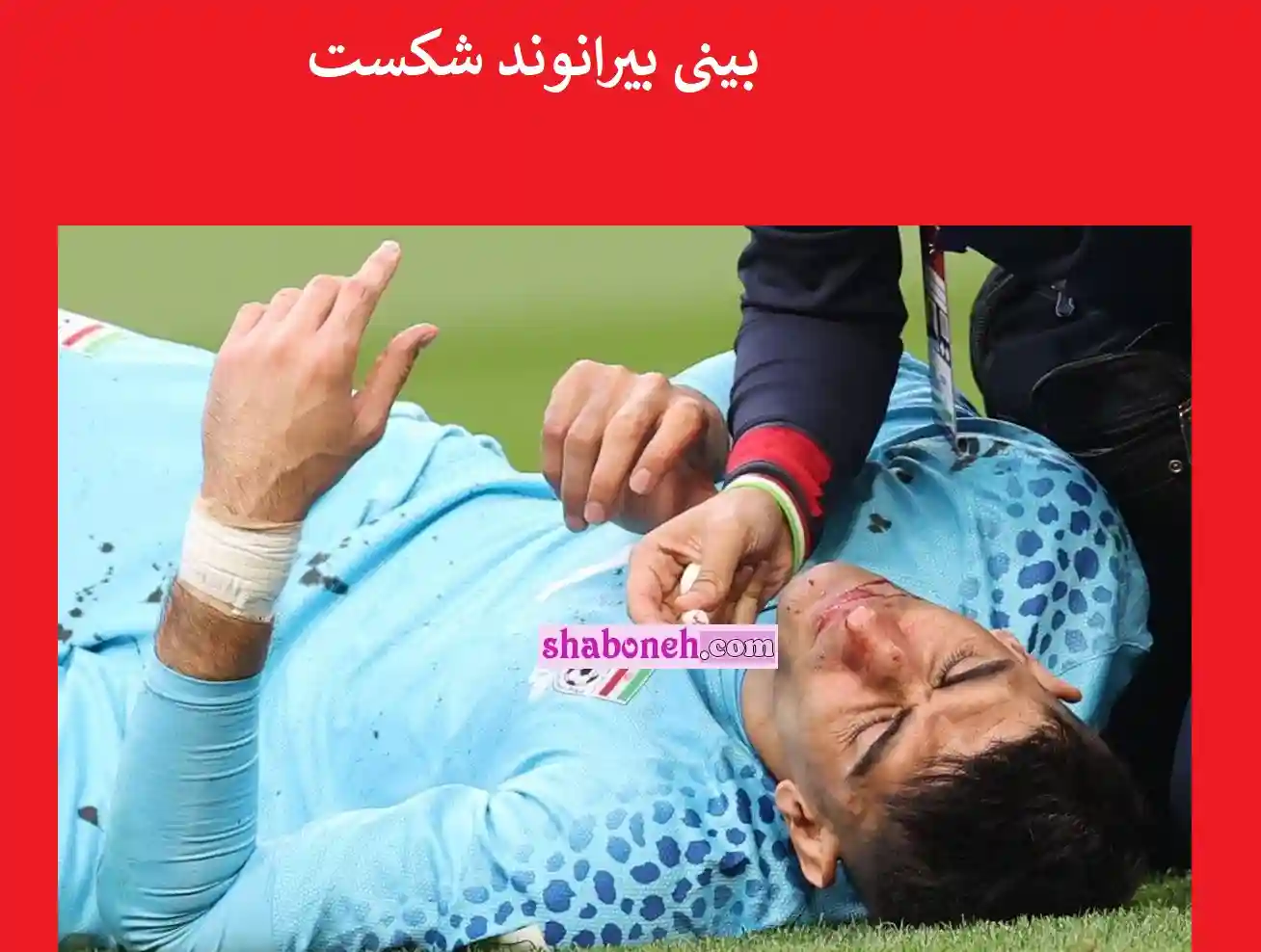 فیلم لحظه شکسته شدن بینی و دماغ علیرضا بیرانوند در بازی ایرانی و انگلیس