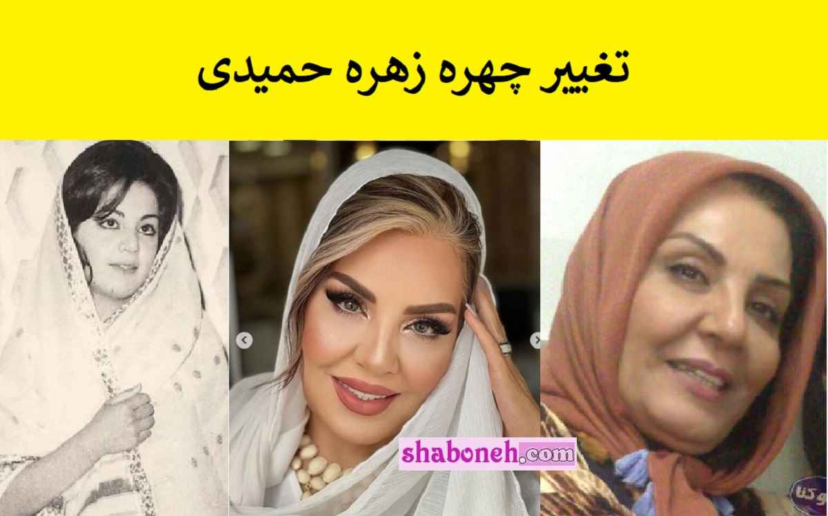 تغییر چهره زهره حمیدی همه را شوکه کرد چهره شکسته زهره حمیدی را ببینید