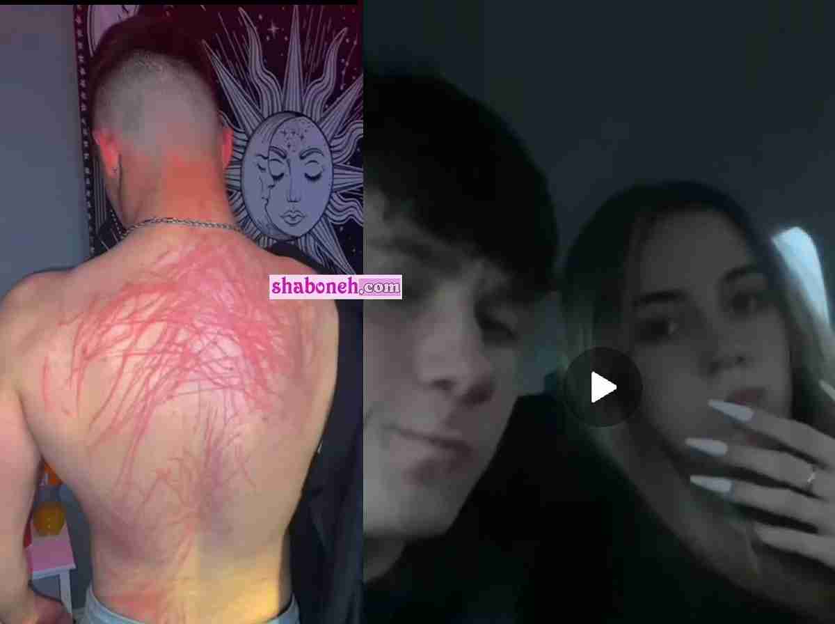 با سگ وارد رابطه میشد کمتر آسیب میدید! ببینید دختره با ناخن چکارش کرده