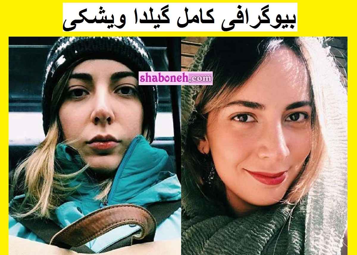 بیوگرافی گیلدا ویشکی بازیگر و همسرش + عکس های جدید و سوابق