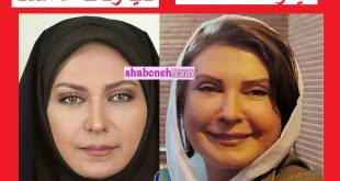 تغییر چهره لعیا زنگنه (بازیگر) با بوتاکس! چرا قیافش این شکلی شده؟