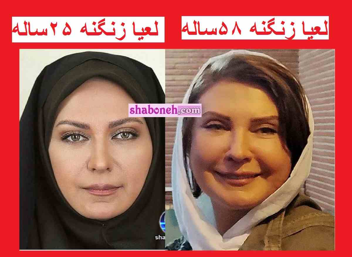 تغییر چهره لعیا زنگنه (بازیگر) با بوتاکس! چرا قیافش این شکلی شده؟