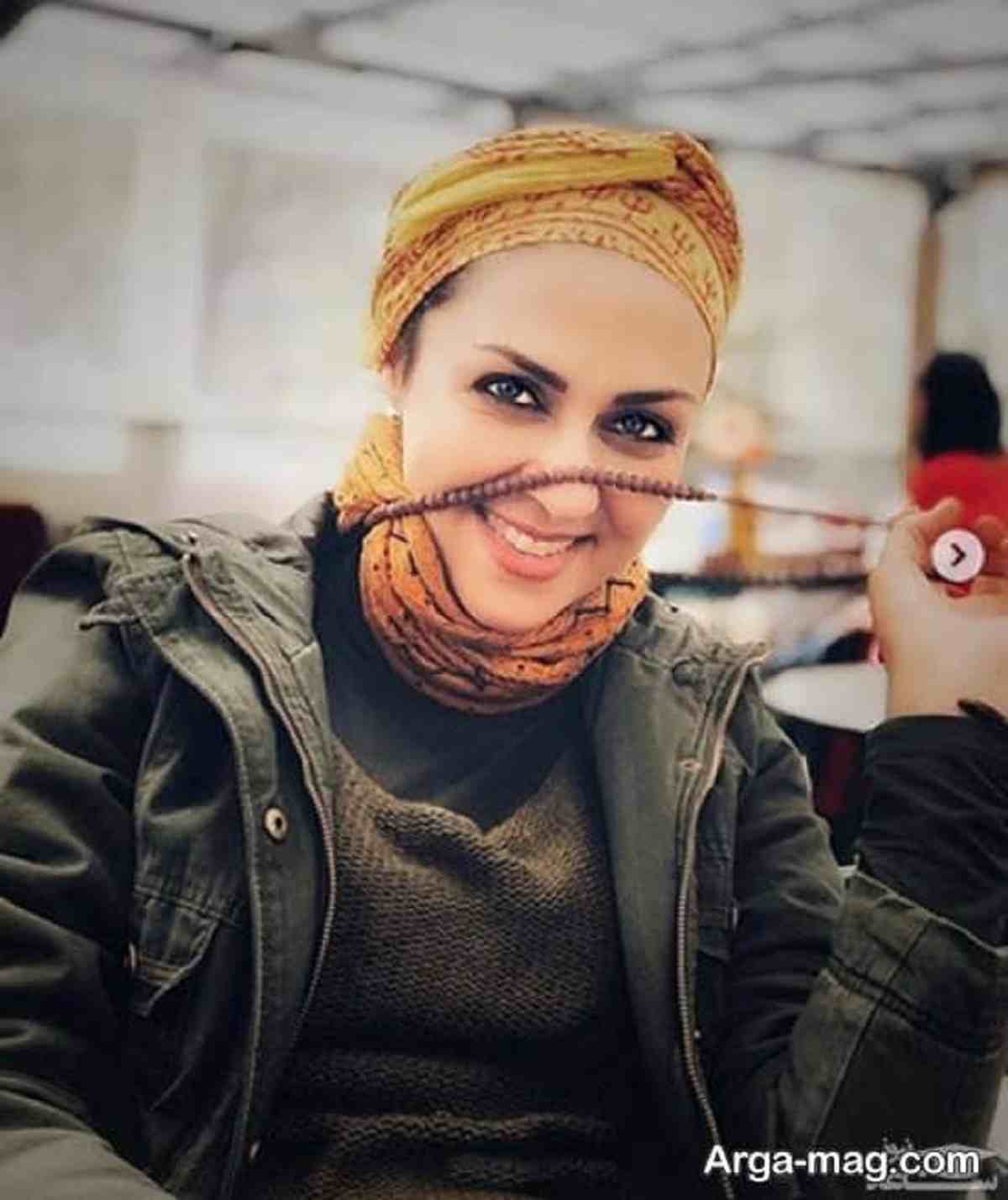 شیوا ابراهیمی بازیگر موهایش را تراشید آیا سرطان دارد؟