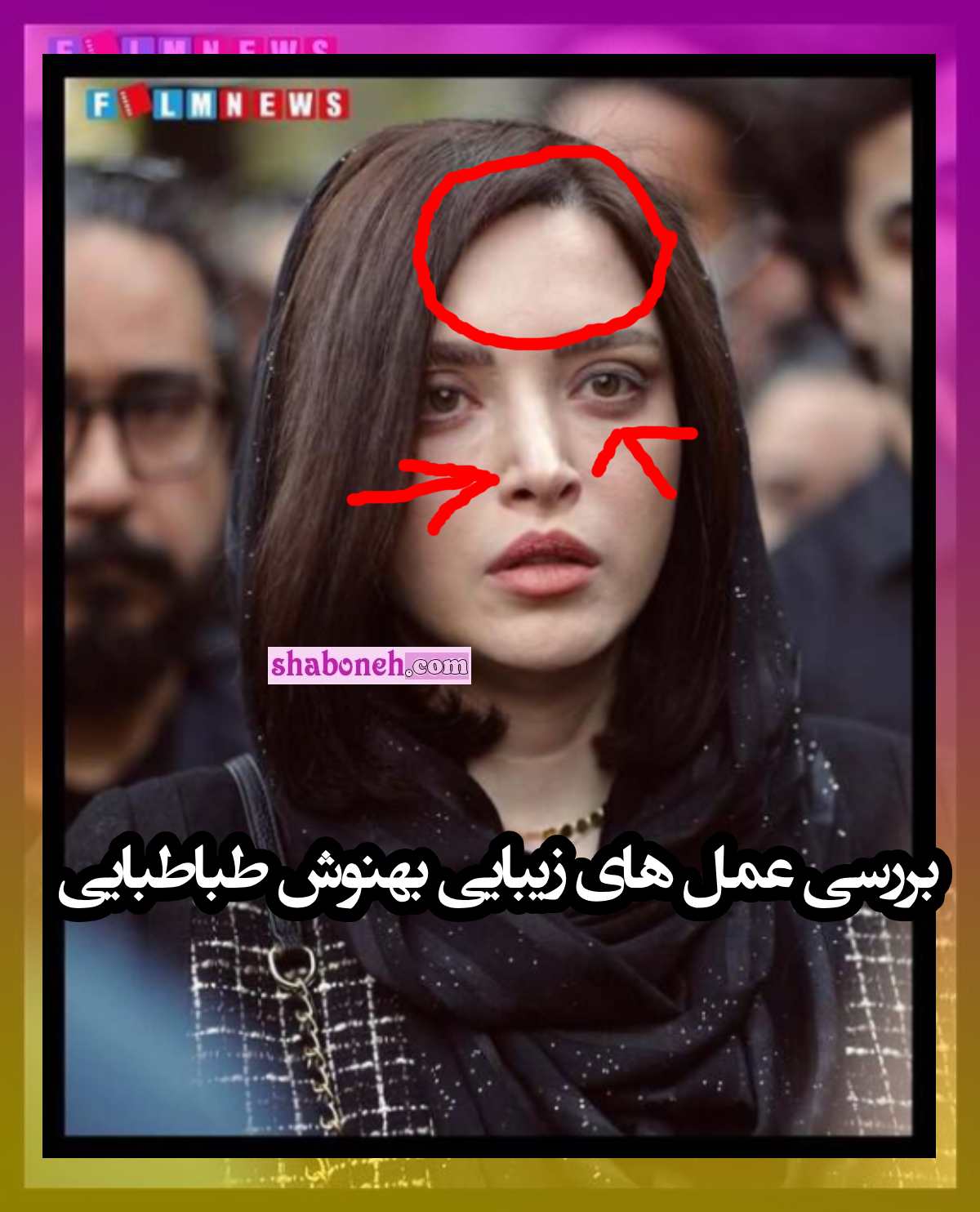 ماجرای چهره جدید بهنوش طباطبایی با عمل زیبایی در مراسم آتیلا پسیانی