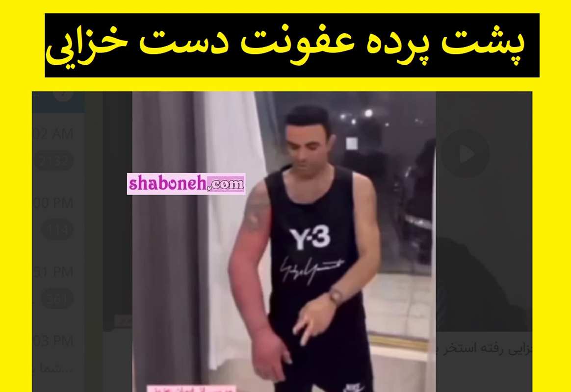 پشت پرده عفونت دست وحید خزایی مشخص شد +فیلم کامل