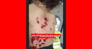 واکنش ها به توهین علی کریمی به شهدای حادثه کرمان از مهناز افشار تا پرستویی
