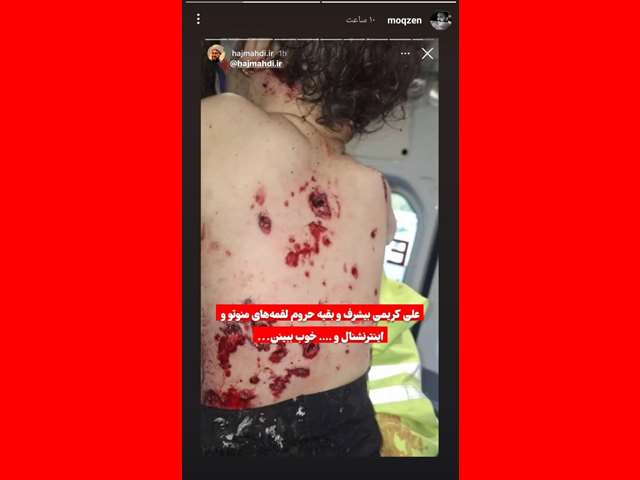 واکنش ها به توهین علی کریمی به شهدای حادثه کرمان از مهناز افشار تا پرستویی