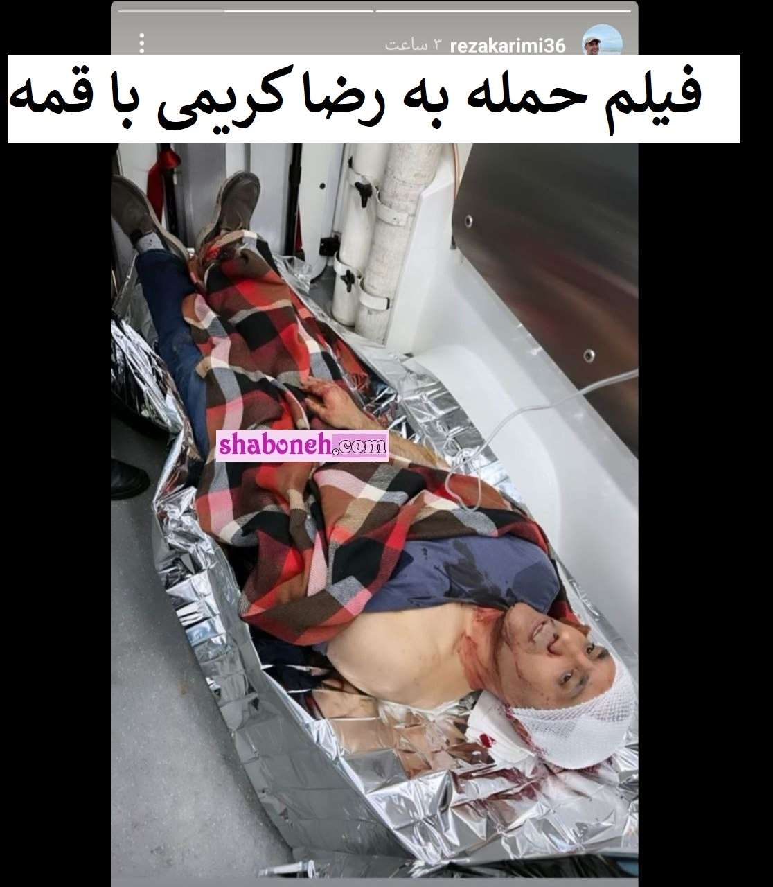 فیلم حمله با قمه به رضا کریمی بازیگر مجروح کردن سرش