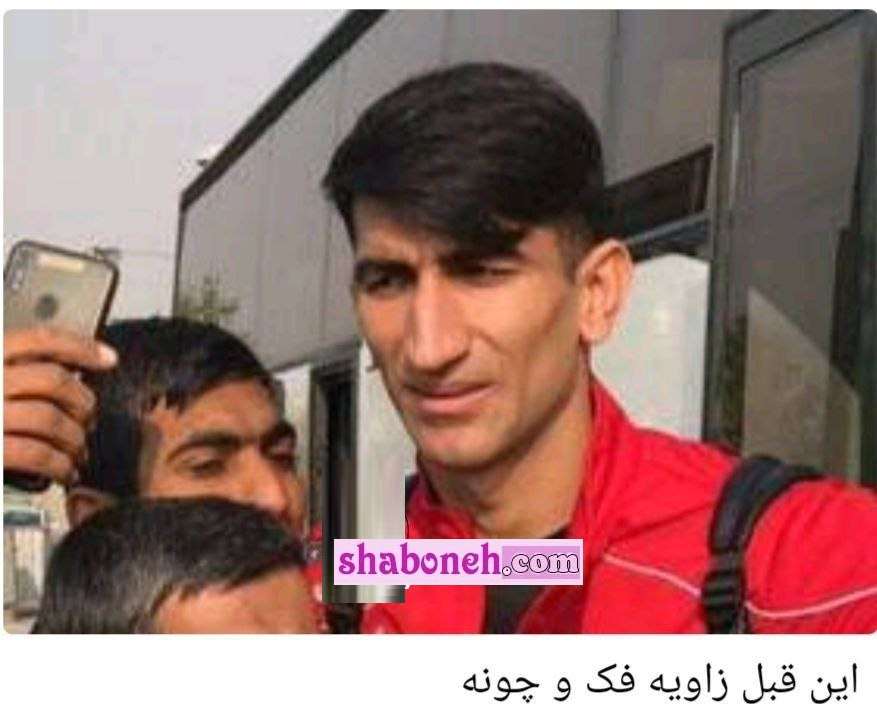 عمل جراحی زیبایی زاویه فک و چونه علیرضا بیرانوند و تزریق ژل 