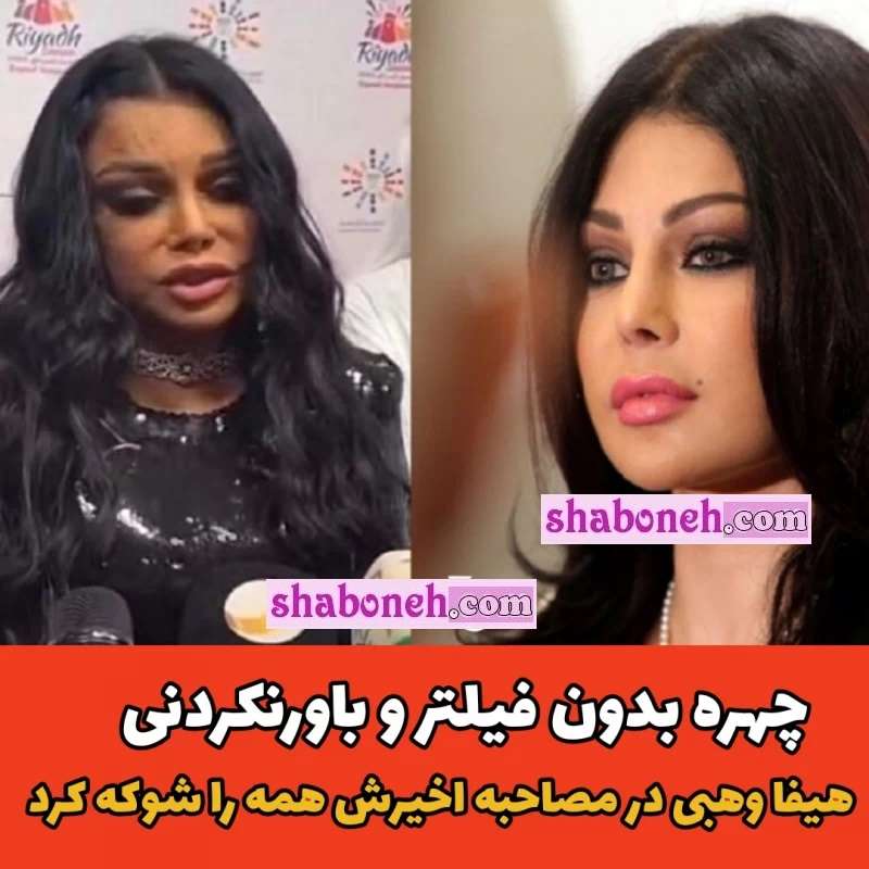 هیفا وهبی قبل و بعد از عمل زیبایی + تصاویر و عکس های قدیمی