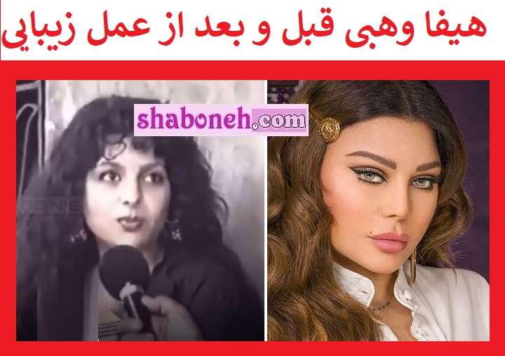 هیفا وهبی قبل عمل زیبایی + تصاویر و عکس های قدیمی