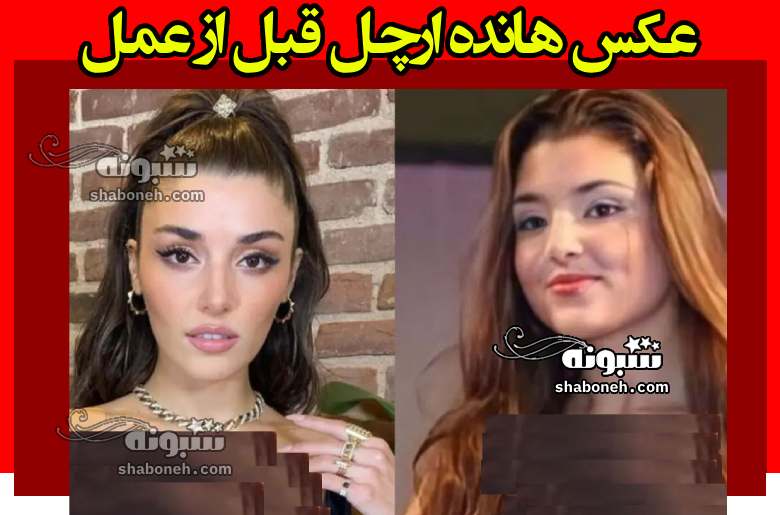 عکس هانده ارچل قبل از عمل و تاریخ تولد هانده ارچل به ایرانی