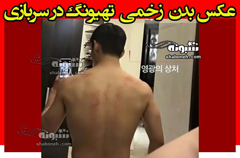 عکس بدن تهیونگ (V بی تی اس bts) در سربازی زخمی شده است