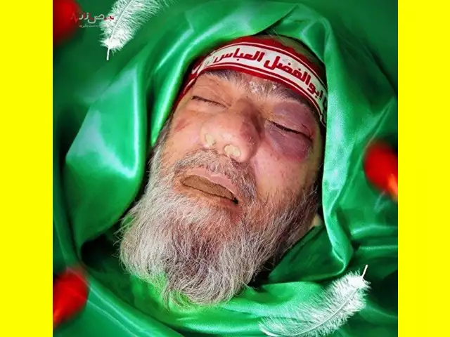 عکس چهره کبود جسد و جنازه و پیکر آیت الله آل هاشم امام جمعه مشهد تصاویر