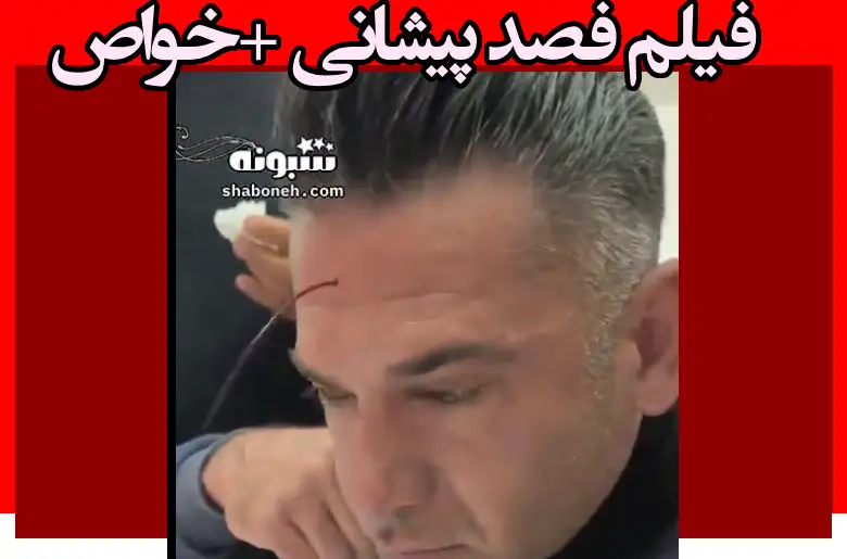 فصد پیشانی چیست + خواص و فواید و فیلم (18+)