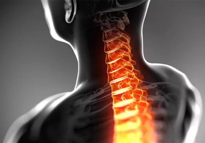 علائم دیسک گردن چیست؟ آیا دیسک گردن درمان دارد؟