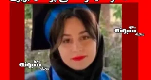 علت زهرا ملکی پرستار تبریزی بعد از عمل زیبایی بینی