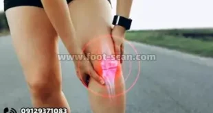 تأثیر تکنولوژی مدرن در درمان آرتروز زانو